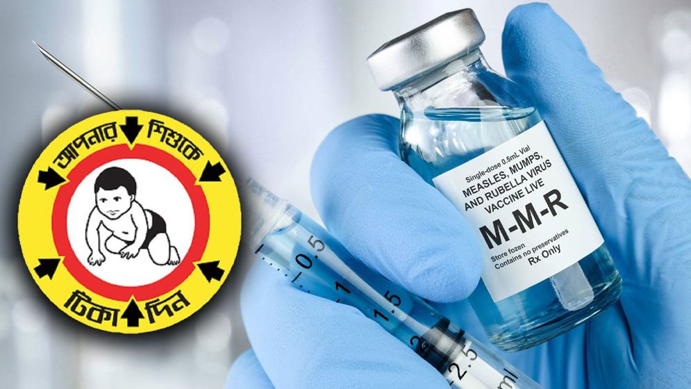১ লাখ শিশুকে শিগগিরই হামের টিকা দেওয়া হবে: স্বাস্থ্যমন্ত্রী