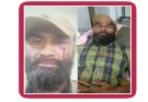 সংবাদ প্রকাশে এক সাংবাদিককে রক্তাক্ত করল শীর্ষ মাদক কারবারি হাওয়ার্ড