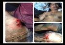 হ্নীলা ইউনিয়নের সাবেক ইউপি সদস্য ও সংবাদকর্মী জামাল উদ্দিনের ওপর সশস্ত্র হামলা